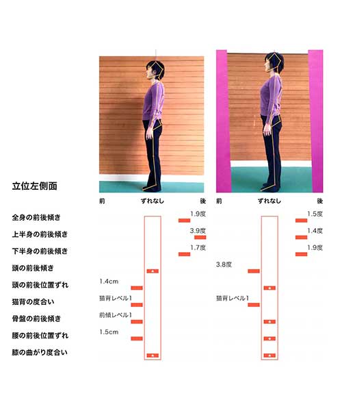 立位左側麺　ずれなし